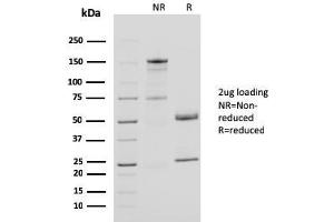 SDS-PAGE Analysis Purified CD40L Mouse Monoclonal Antibody (CD40LG/2761). (CD40 Ligand 抗体  (AA 108-261))