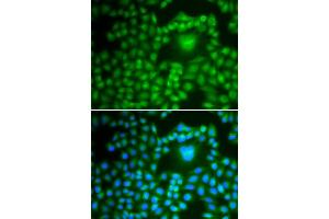 Immunofluorescence analysis of U2OS cells using PP1 beta antibody . (PPP1CB 抗体  (AA 1-327))