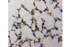 Used in DAB staining on fromalin fixed paraffin-embedded Lung tissue (TBX4 抗体  (AA 284-545))