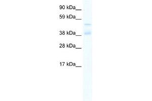 WB Suggested Anti-ZNF17 Antibody Titration:  0. (ZNF17 抗体  (N-Term))