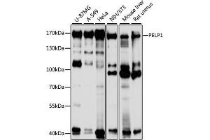 Western Blotting (WB) image for anti-Proline-, Glutamic Acid- and Leucine-Rich Protein 1 (PELP1) (AA 1021-1180) antibody (ABIN3023502)