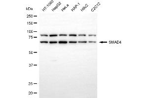 Western blotting analysis using SMAD4 antibody (ABIN7800364).