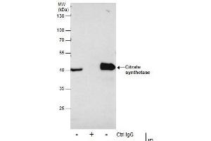 Immunoprecipitation (IP) image for anti-Citrate Synthase (CS) antibody (ABIN2856769)