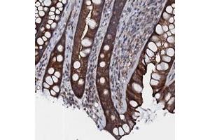 Immunohistochemical staining of human rectum with TMEM151A polyclonal antibody  shows strong cytoplasmic positivity in glandular cells. (TMEM151A 抗体)