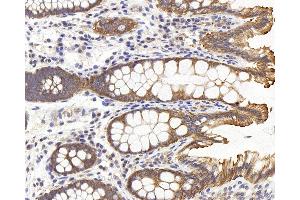 Immunohistochemistry analysis of paraffin-embedded human colon using PERK Polyclonal Antibody at dilution of 1:500. (PERK 抗体)