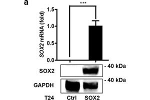 SOX2 mediates growth of bladder cancer cells. (SOX2 抗体)