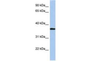 Image no. 1 for anti-Low Density Lipoprotein Receptor Adaptor Protein 1 (LDLRAP1) (AA 35-84) antibody (ABIN6743822)