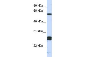 WB Suggested Anti-HABP2 Antibody Titration: 0. (HABP2 抗体  (Middle Region))
