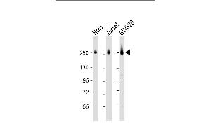 All lanes : Anti-CAD Antibody (Center) at 1:2000 dilution Lane 1: Hela whole cell lysate Lane 2: Jurkat whole cell lysate Lane 3: S whole cell lysate Lysates/proteins at 20 μg per lane. (CAD 抗体  (AA 780-809))