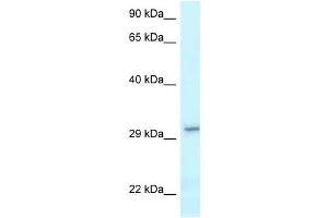 Western Blot showing VTI1B antibody used at a concentration of 1 ug/ml against NCI-H226 Cell Lysate (VTI1B 抗体  (C-Term))