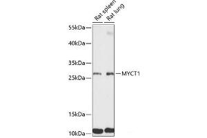 Western blot analysis of extracts of various cell lines using MYCT1 Polyclonal Antibody at dilution of 1:3000. (Myc Target 1 抗体)