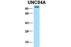 Host:  Rabbit  Target Name:  UNC84A  Sample Type:  Human Fetal Lung  Antibody Dilution:  1.
