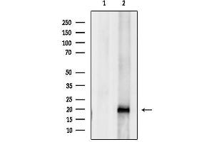 anti-Ubiquitin-Conjugating Enzyme E2C (UBE2C) (C-Term) antibody