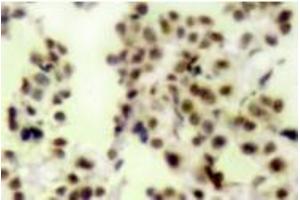 Image no. 2 for anti-Tumor Protein P73 (TP73) (pTyr99) antibody (ABIN318099)