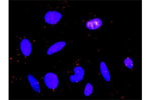 Proximity Ligation Assay (PLA) image for anti-Platelet Derived Growth Factor Receptor beta (PDGFRB) (AA 1-1106) antibody (ABIN518745)