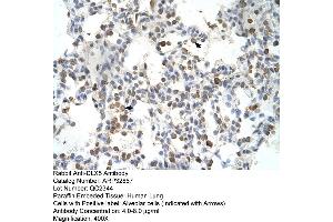 Human Lung (DLX5 抗体  (Middle Region))