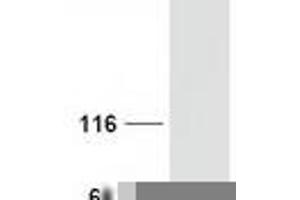 Western Blotting (WB) image for Neuro-Oncological Ventral Antigen 1 (NOVA1) (Transcript Variant 1) protein (Myc-DYKDDDDK Tag) (ABIN2727488)