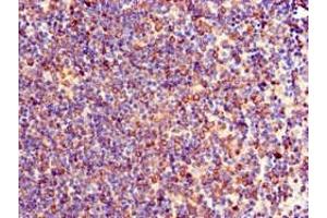 Immunohistochemistry of paraffin-embedded human lymph node tissue using ABIN7174076 at dilution of 1:100 (TXK 抗体  (AA 32-83))