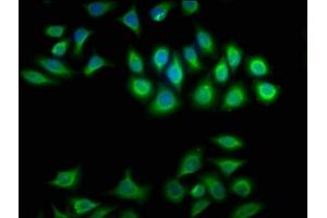 Immunofluorescence staining of A549 cells with ABIN7145462 at 1:100, counter-stained with DAPI. (CRYBA1 抗体  (AA 1-215))