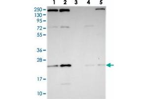 Western blot analysis of Lane 1: RT-4, Lane 2: U-251 MG, Lane 3: Human Plasma, Lane 4: Liver, Lane 5: Tonsil with THOC7 polyclonal antibody  at 1:250-1:500 dilution.