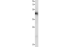 Gel: 12 % SDS-PAGE, Lysate: 40 μg, Lane: Human liver cancer tissue, Primary antibody: ABIN7191316(LRP1 Antibody) at dilution 1/1250, Secondary antibody: Goat anti rabbit IgG at 1/8000 dilution, Exposure time: 40 seconds (LRP1 抗体)