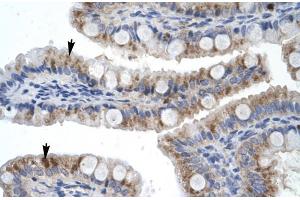 Rabbit Anti-ZNF341 Antibody Catalog Number: ARP30014 Paraffin Embedded Tissue: Human Intestine Cellular Data: Epithelial cells of intestinal villas Antibody Concentration: 4. (ZNF341 抗体  (Middle Region))