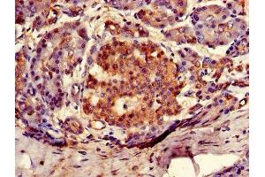 Immunohistochemistry of paraffin-embedded human pancreatic tissue using ABIN7144693 at dilution of 1:100 (ARSG 抗体  (AA 17-525))