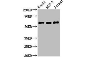 Western Blot Positive WB detected in: HepG2 whole cell lysate, MCF-7 whole cell lysate, Jurkat whole cell lysate All lanes: PRUNE1 antibody at 4 μg/mL Secondary Goat polyclonal to rabbit IgG at 1/50000 dilution Predicted band size: 51, 43, 31, 27, 25, 19 kDa Observed band size: 60 kDa (Exopolyphosphatase PRUNE1 (PRUNE1) (AA 1-168) 抗体)