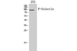 Western Blotting (WB) image for anti-Selectin P (Granule Membrane Protein 140kDa, Antigen CD62) (SELP) (Internal Region) antibody (ABIN3188020) (P-Selectin 抗体  (Internal Region))