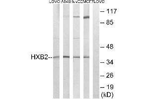 Western blot analysis of extracts from LOVO cells, A549 cells, HUVEC cells and MCF-7 cells, using HOXB2 antibody. (HOXB2 抗体  (Internal Region))