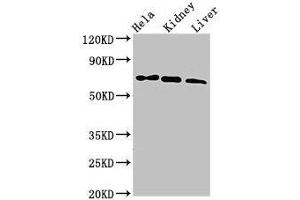 Western Blot Positive WB detected in: Hela whole cell lysate, Mouse kidney tissue, Mouse liver tissue All lanes: MLPH antibody at 3 μg/mL Secondary Goat polyclonal to rabbit IgG at 1/50000 dilution Predicted band size: 66, 63, 53, 61, 51 kDa Observed band size: 66 kDa (Melanophilin 抗体  (AA 310-539))