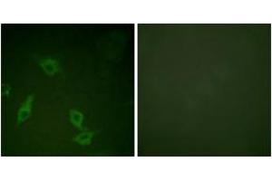 Immunofluorescence analysis of HeLa cells, using FAK (Ab-397) Antibody. (FAK 抗体  (AA 363-412))