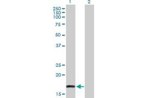Western Blot analysis of PSCA expression in transfected 293T cell line by PSCA MaxPab polyclonal antibody. (PSCA 抗体  (AA 1-123))