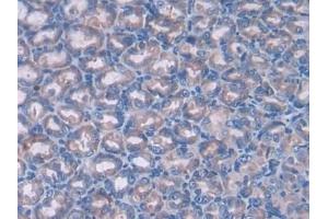 Detection of PTCH1 in Mouse Stomach Tissue using Polyclonal Antibody to Patched Homolog 1 (PTCH1) (Patched 1 抗体  (AA 213-422))