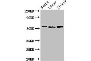 Western Blot Positive WB detected in: Mouse heart tissue, Mouse liver tissue, Mouse kidney tissue All lanes: SOX9 antibody at 3 μg/mL Secondary Goat polyclonal to rabbit IgG at 1/50000 dilution Predicted band size: 57 kDa Observed band size: 57 kDa (SOX9 抗体  (AA 296-501))