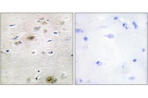 Immunohistochemistry analysis of paraffin-embedded human brain tissue, using TRA-2 alpha Antibody. (TRA2A 抗体  (AA 221-270))