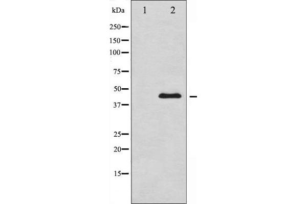 GATA4 anticorps  (pSer105)