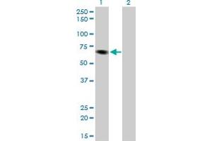 Western Blot analysis of ITPKB expression in transfected 293T cell line by ITPKB monoclonal antibody (M01), clone 2F8. (ITPKB 抗体  (AA 545-643))