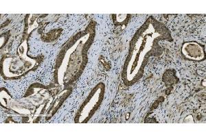 IHC analysis of PARP using anti-PARP antibody (ABIN7602276). (PARP1 抗体  (AA 670-858))