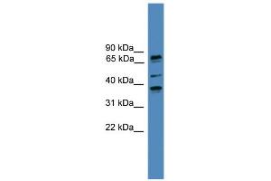 WB Suggested Anti-BBS5 Antibody Titration: 0. (BBS5 抗体  (N-Term))