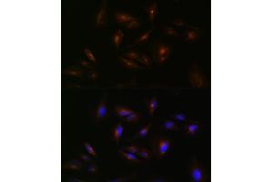 Immunofluorescence (IF) image for anti-ATP-Binding Cassette, Sub-Family A (ABC1), Member 2 (ABCA2) (AA 2307-2466) antibody (ABIN7265728)