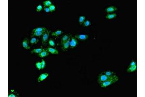 Immunofluorescent analysis of HepG2 cells using ABIN7161378 at dilution of 1:100 and Alexa Fluor 488-congugated AffiniPure Goat Anti-Rabbit IgG(H+L) (Doublecortin 抗体  (AA 108-360))