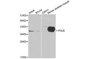 Western Blotting (WB) image for anti-Polymerase (DNA Directed), beta (POLB) (AA 1-335) antibody (ABIN3022385)