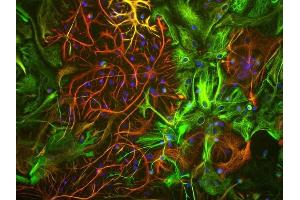 View of mixed neuron/glial cultures stained with ABIN1580468 (green) our rabbit antibody to GFAP antibody (RPCA-GFAP, red). (Vimentin 抗体)