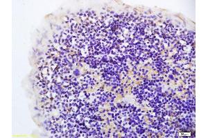 Formalin-fixed and paraffin embedded rat spleen labeled with Anti-Hairless Polyclonal Antibody, Unconjugated (ABIN1387668) at 1:200 followed by conjugation to the secondary antibody and DAB staining. (Hairless 抗体  (AA 345-460))