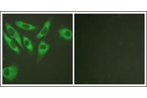 Immunofluorescence analysis of HeLa cells, using S6 Ribosomal Protein. (RPS6 抗体  (C-Term))