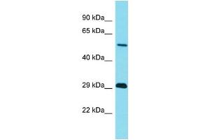 Western Blotting (WB) image for anti-Tripartite Motif Containing 43B (TRIM43B) (N-Term) antibody (ABIN2791466) (TRIM43B 抗体  (N-Term))