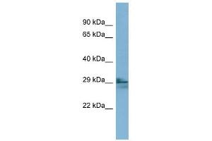 LIM2 antibody used at 1 ug/ml to detect target protein. (LIM2 抗体  (N-Term))