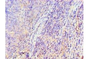 Immunohistochemistry of paraffin-embedded human tonsil tissue using ABIN7153301 at dilution of 1:100 (GRK6 抗体  (AA 1-170))