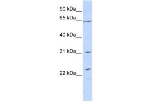 EME1 antibody used at 1 ug/ml to detect target protein. (Crossover junction endonuclease EME1 (EME1) 抗体)